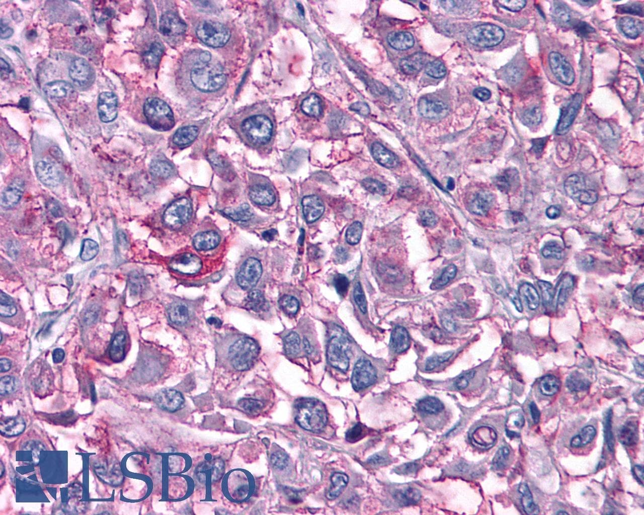 PathPlus™ Polyclonal Rabbit anti-Human GPR6 Antibody (C-Terminus, IHC)