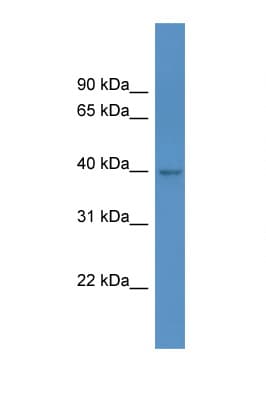 HPDL Antibody (aa253-302)