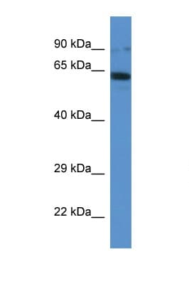 IFT80 Antibody (aa535-584)