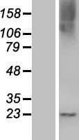 RASL10B Protein (Over-Expression Lysate Myc-DDK (Flag))