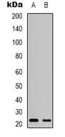 MGMT Antibody (N-Terminus)