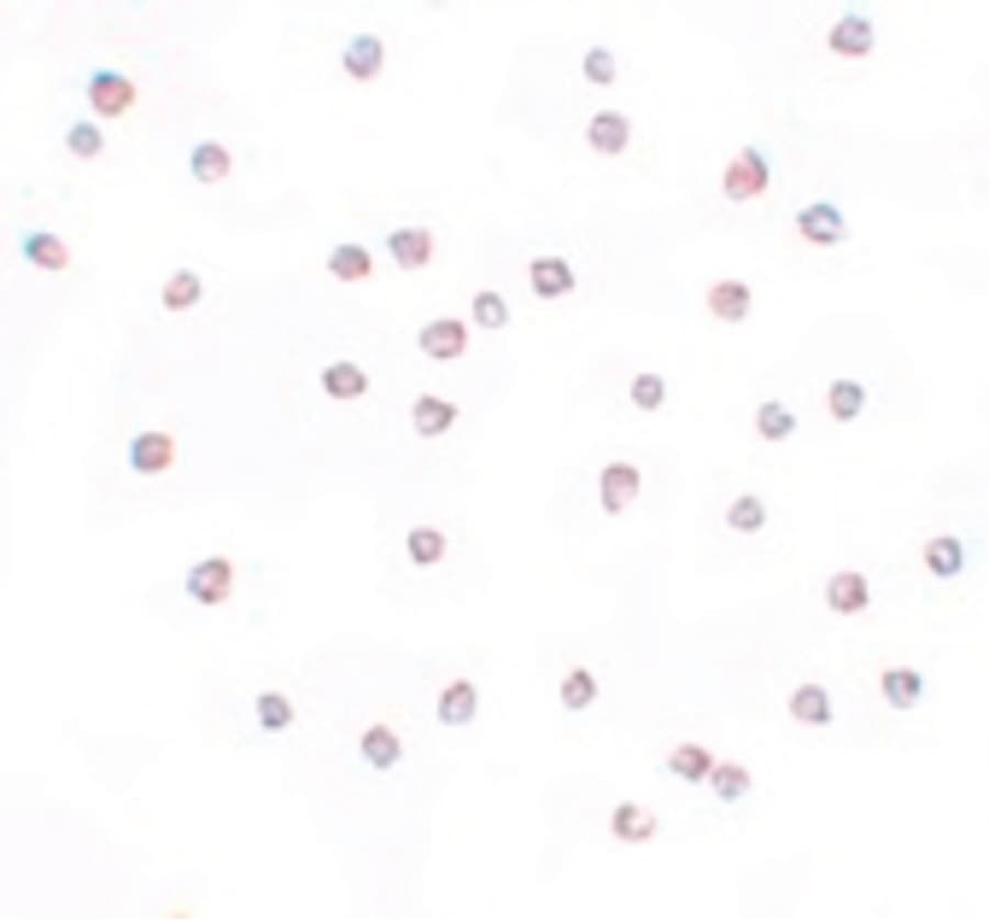 IHC-plus™ FREM2 Antibody
