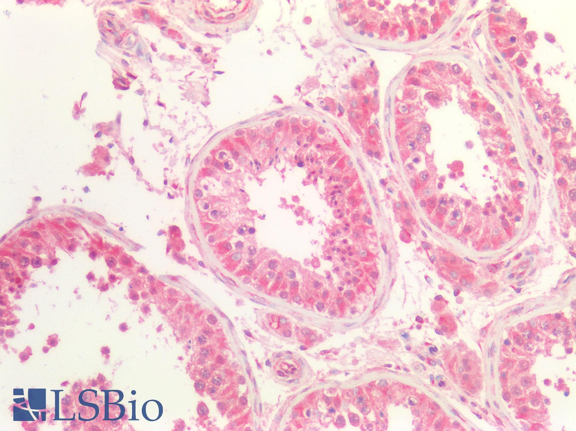 IHC-plus™ Polyclonal Rabbit anti-Human ATXN2 / SCA2 / Ataxin-2 Antibody (aa721-780, IHC, WB)