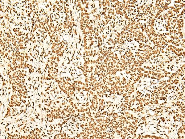 Polyclonal Rabbit anti-Human NF90 / ILF3 Antibody (IHC)