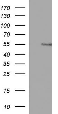 ANKMY2 Antibody (clone OTI1D8, Carrier-free)