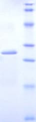 Mouse DLAT / PDC-E2 Protein (Recombinant His, N-Terminal)