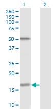 FUT2 / SE Antibody (clone 4C12)