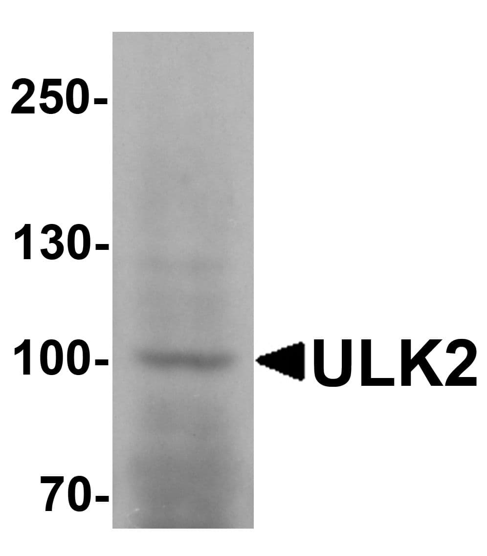 IHC-plus™ ULK2 Antibody