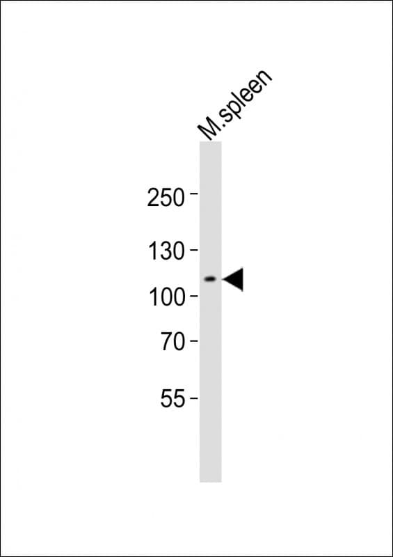 MER / MERTK Antibody (aa946-980)