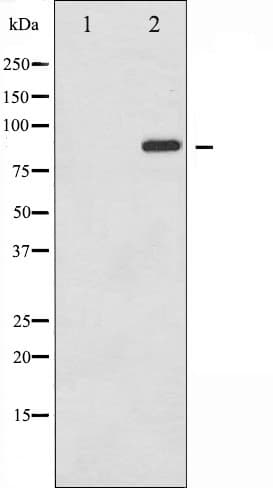 STAT6 Antibody (phospho-Tyr641)