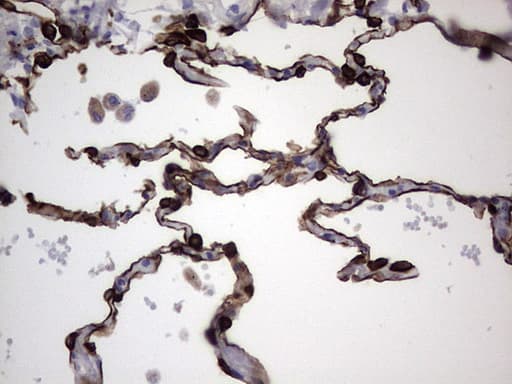 KRT19 / CK19 / Cytokeratin 19 Antibody (aa240-390, clone OTI3D10)