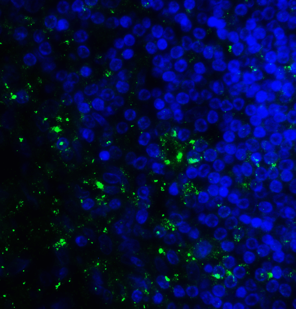 CD276 / B7-H3 Antibody (clone 10G6)