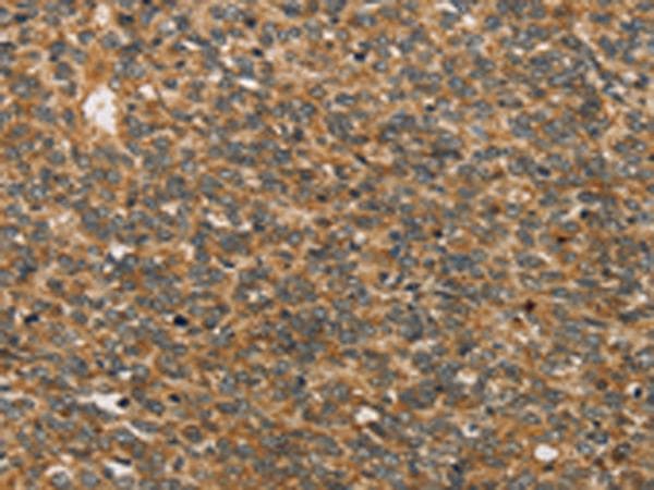 Polyclonal Rabbit anti-Human XPR1 Antibody (IHC)