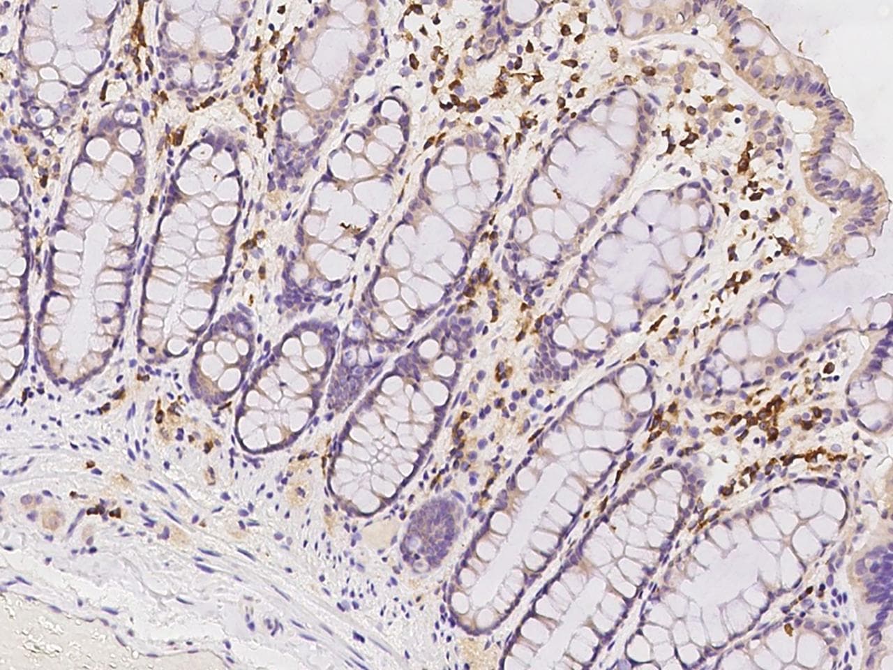 Polyclonal Rabbit anti-Human PABPC4 Antibody (IHC, IF, WB)