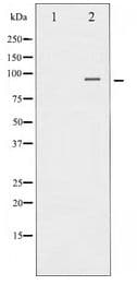 CTNNB1 / Beta Catenin Antibody