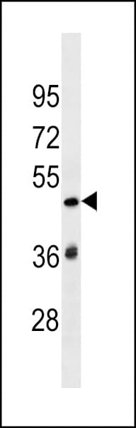 Polyclonal Rabbit anti-Human SP140L Antibody (aa158-185, WB)