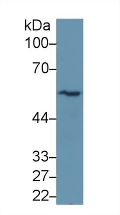 TUBB / Beta Tubulin Antibody (PE)