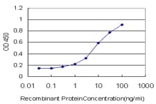 IHC-plus™ Monoclonal Mouse anti-Human MEF2A / MEF2 Antibody (clone 1D11, IHC, WB)