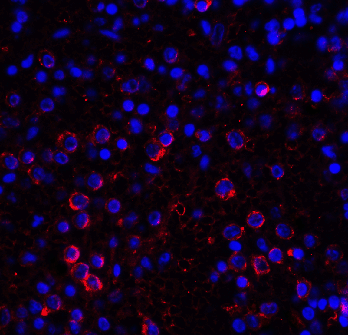 IHC-plus™ Monoclonal Mouse anti-Human VSIR / GI24 / VISTA Antibody (clone 4C4, IHC, IF, WB)