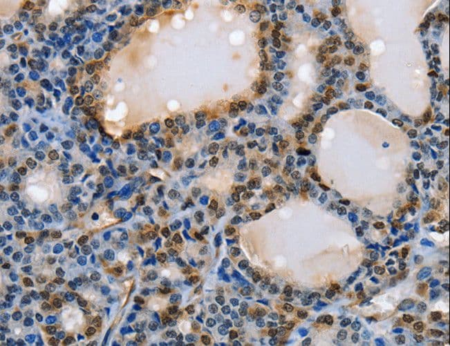 Polyclonal Rabbit anti-Human NFKBID / IkappaBNS Antibody (IHC, WB)