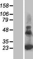 Human PERP Protein (Over-Expression Lysate Myc-DDK (Flag))
