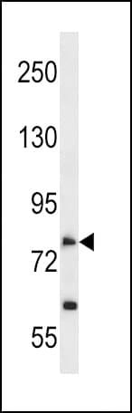 Polyclonal Rabbit anti-Human SLC28A2 Antibody (aa14-42, WB)