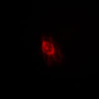 Polyclonal Rabbit anti-Human IRS1 Antibody (Internal, IHC, IF, WB)