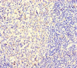 Polyclonal Rabbit anti-Human NGN / Neogenin Antibody (IHC, IF)