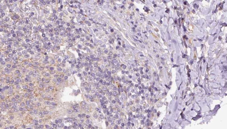 EAT2 / SH2D1B Antibody