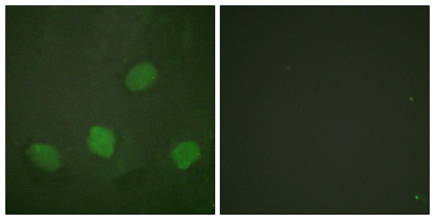 Polyclonal Rabbit anti-Human CREB1 / CREB Antibody (phospho-Ser142, IHC, IF, WB)