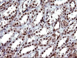 UPRT Antibody (clone OTI2D1)