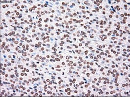 PLK1 / PLK-1 Antibody (clone OTI1D4)