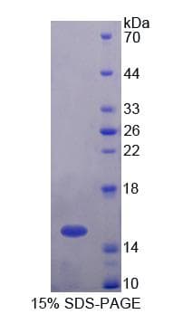Human UBAP2 Protein (Recombinant His-T7)