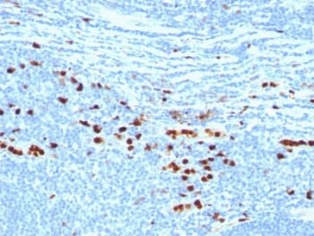 S100A9 / MRP14 Antibody (clone MAC387)