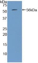 PTH / Parathyroid Hormone Protein (Native His-MBP, N-terminus)