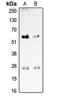 PROCR / EPCR Antibody (Internal)