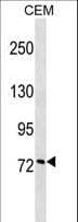 Polyclonal Rabbit anti-Human CCNF / Cyclin F Antibody (aa496-524, WB)
