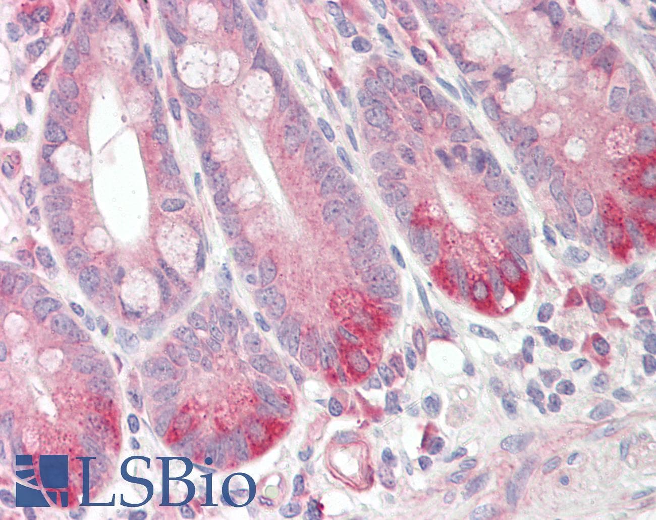 IHC-plus™ GPR160 Antibody (Internal)