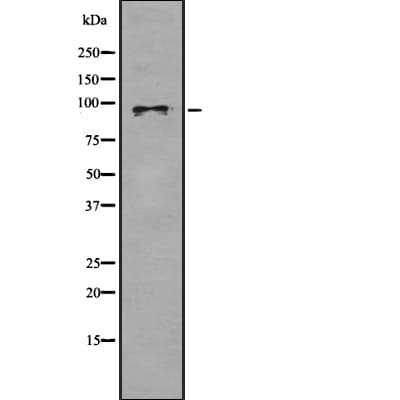 SEMA4D / Semaphorin 4D / CD100 Antibody