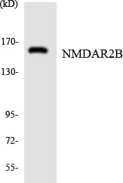GRIN2B / NMDAR2B / NR2B Antibody (aa1419-1468)