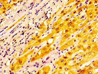 Polyclonal Rabbit anti-Human ADH1A / Alcohol Dehydrogenase Antibody (IHC)