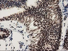 NMNAT1 / NMNAT Antibody (clone OTI1G4)