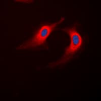 ABHD12B Antibody (C-Terminus)