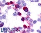 IHC-plus™ CCR7 Antibody (C-Terminus)