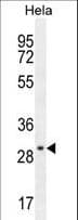 EMG1 / NEP1 Antibody (aa104-133)
