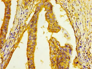 HSD17 / HSD17B1 Antibody