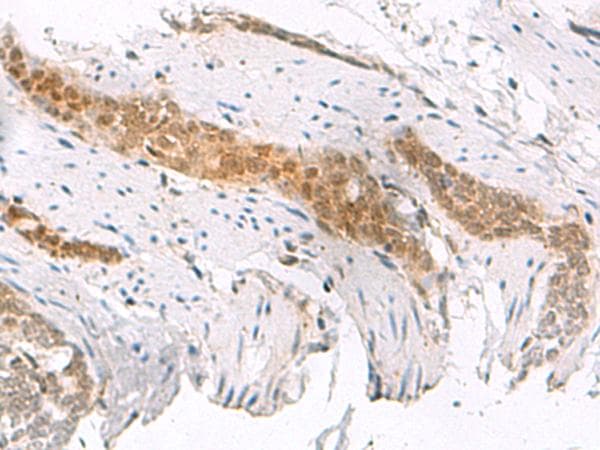 SCAND1 Antibody