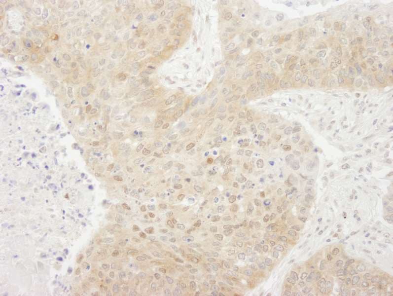 Polyclonal Rabbit anti-Human CRTC1 / MECT1 / TORC1 Antibody (aa600-C-term, IHC)