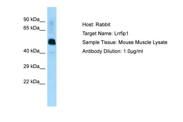TRIP / LRRFIP1 Antibody (aa111-160)