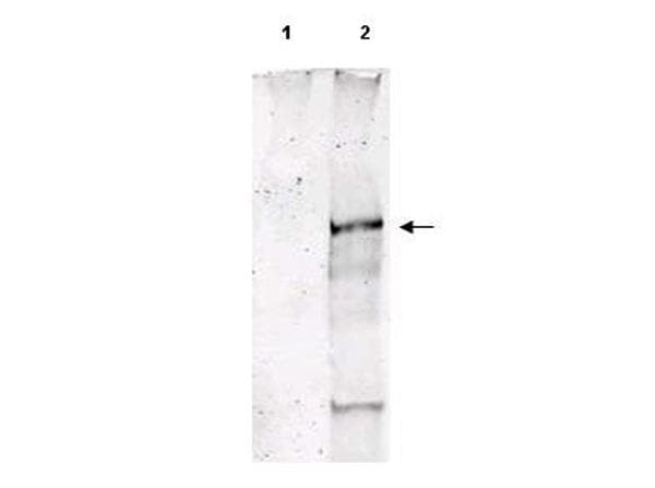 ATM Antibody (phospho-Ser1981)